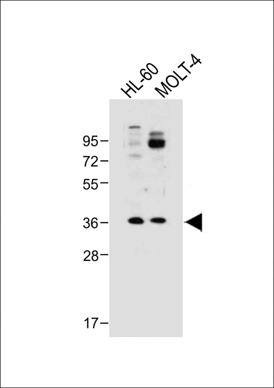 Rabbit Polyclonal Antibody to RQCD1