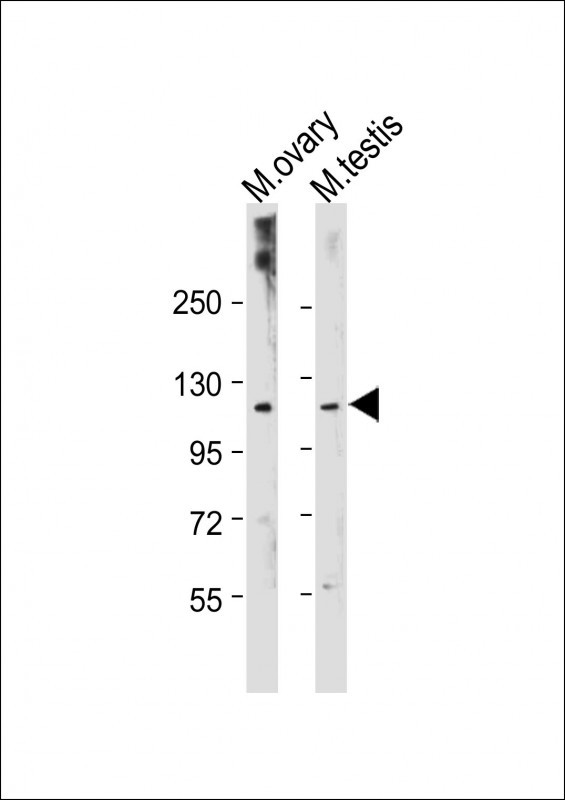 Rabbit Polyclonal Antibody to Mouse Lats2(C-term)