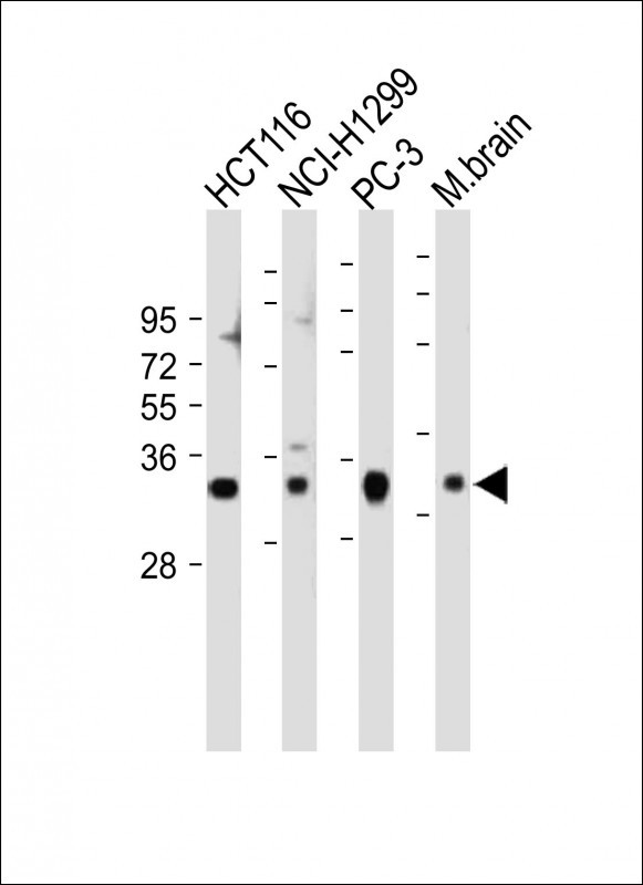 Rabbit Polyclonal Antibody to VDAC2 (N-term)