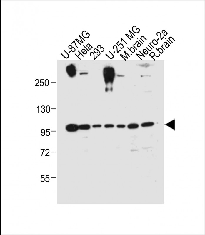 Rabbit Polyclonal Antibody to FGFR(Y766)