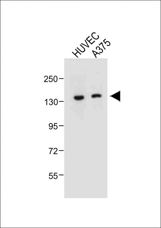 Rabbit Polyclonal Antibody to TECPR1