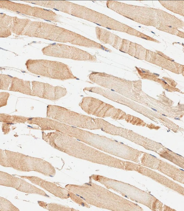 Rabbit Polyclonal Antibody to METTL4