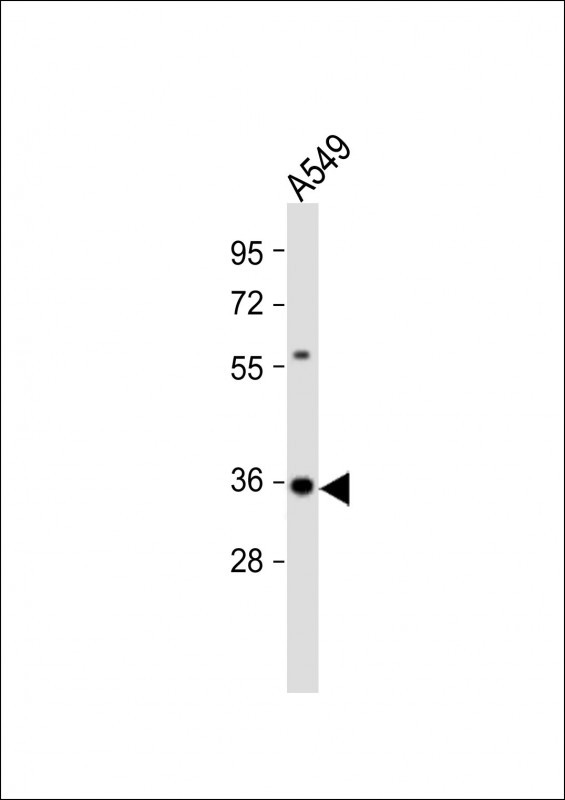 Rabbit Polyclonal Antibody to CASP5