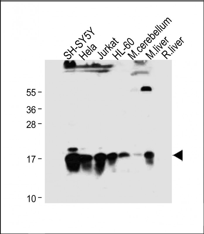 Rabbit Polyclonal Antibody to SUMO2/3