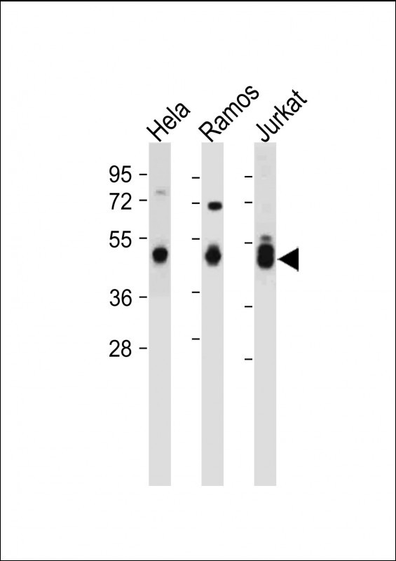 Rabbit Polyclonal Antibody to MAT2A (N-term)