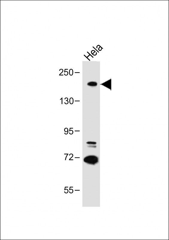 Rabbit Polyclonal Antibody to DIP2A