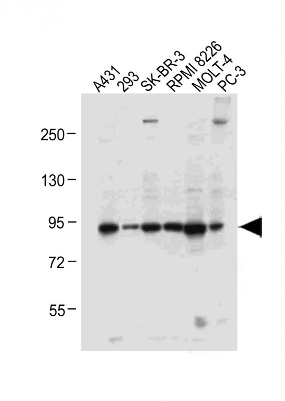 Rabbit Polyclonal Antibody to ADAMTS17