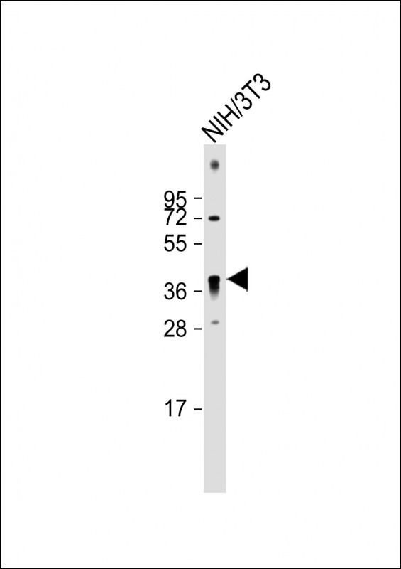 Rabbit Polyclonal Antibody to QKI (N-term)