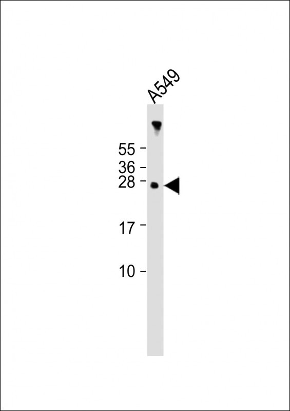 Rabbit Polyclonal Antibody to AANAT (N-term)