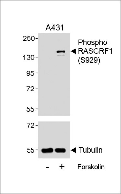 Rabbit Polyclonal Antibody to Phospho-RASGRF1(S929)