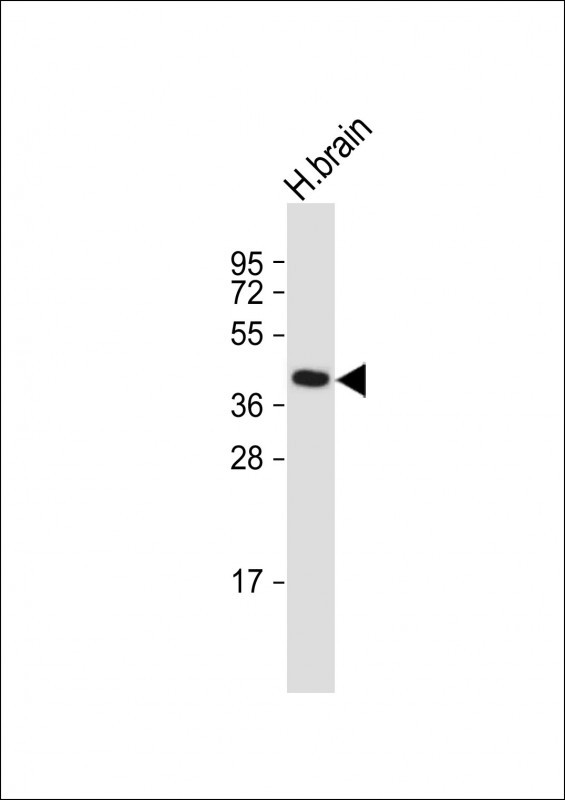 Rabbit Polyclonal Antibody to GFRAL