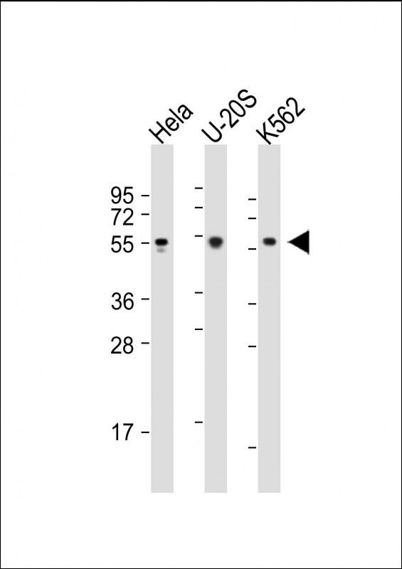 Rabbit Polyclonal Antibody to AIRE