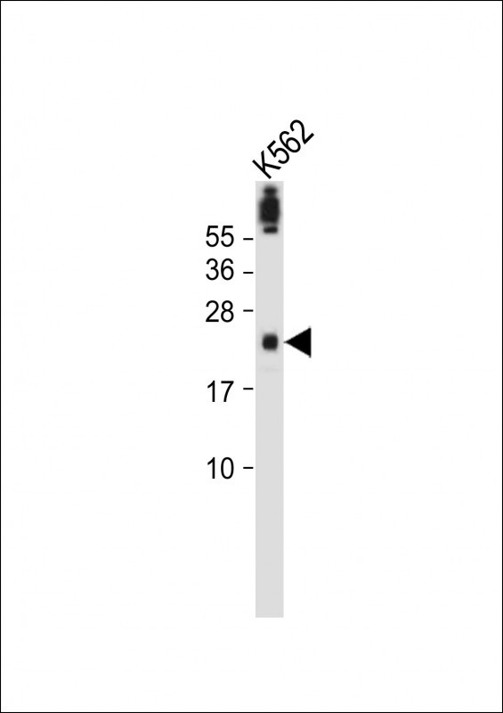 Rabbit Polyclonal Antibody to FA96A  (C-term)