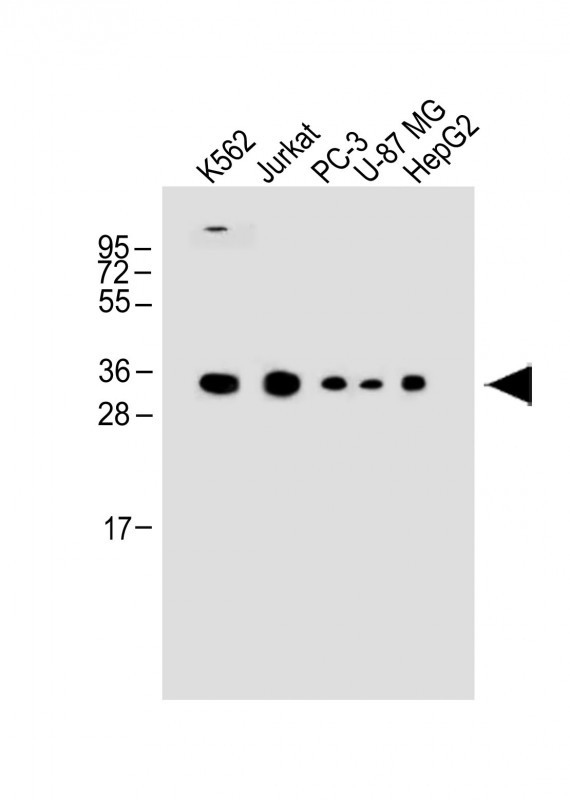 Rabbit Polyclonal Antibody to PPP1R3G