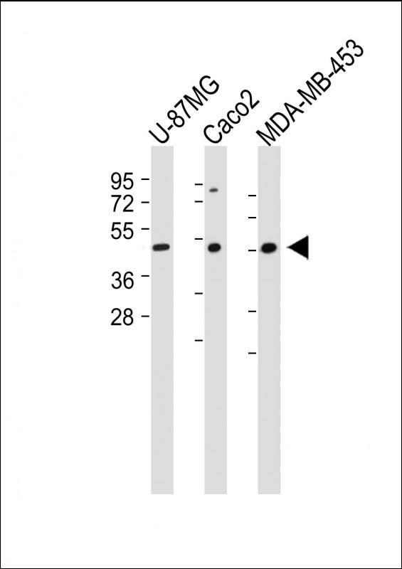 Rabbit Polyclonal Antibody to KCNJ13 (N-term)