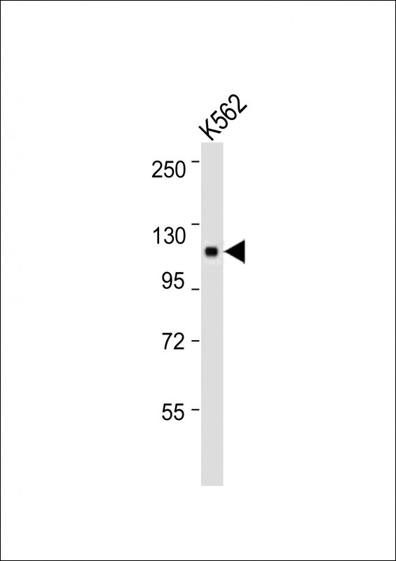 Rabbit Polyclonal Antibody to LRIG2