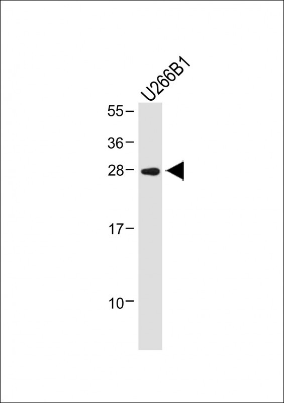 Rabbit Polyclonal Antibody to IGLL5