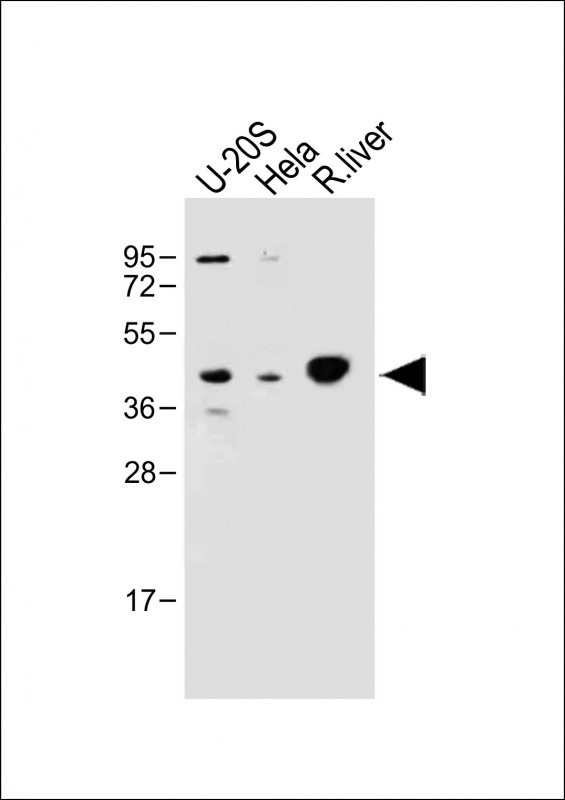 Rabbit Polyclonal Antibody to IDAS (N-term)