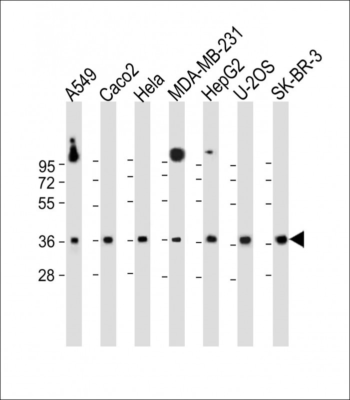 Rabbit Polyclonal Antibody to GATSL1 (N-term)