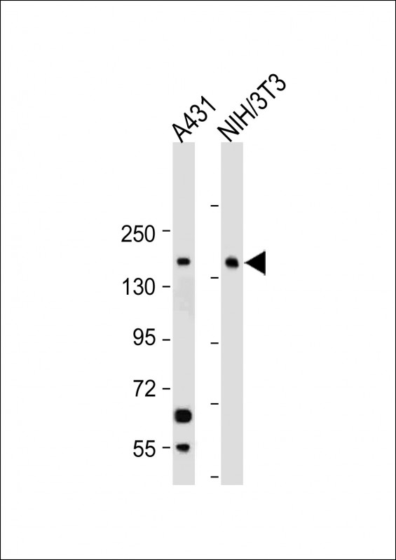 Rabbit Polyclonal Antibody to RECQL4(C-term)