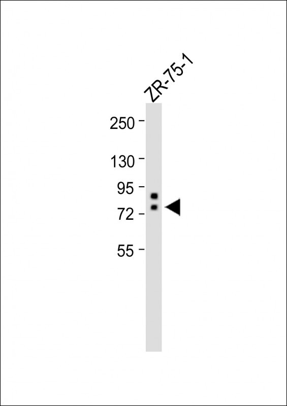Rabbit Polyclonal Antibody to ERVK-9