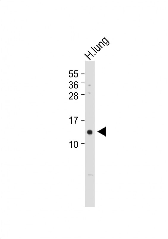 Rabbit Polyclonal Antibody to VKORC1 (N-term)