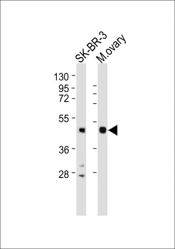 Rabbit Polyclonal Antibody to INHA (N-term)