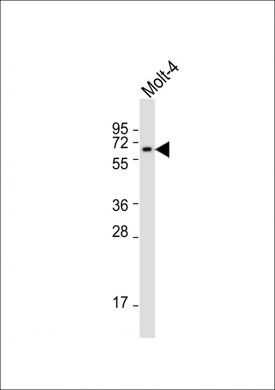 Rabbit Polyclonal Antibody to CHC1L (N-term)