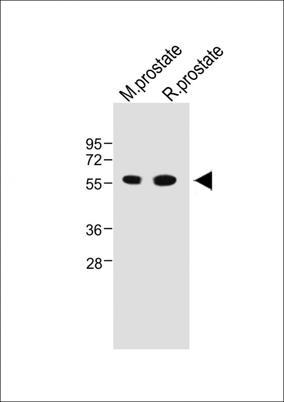 Rabbit Polyclonal Antibody to ACPP