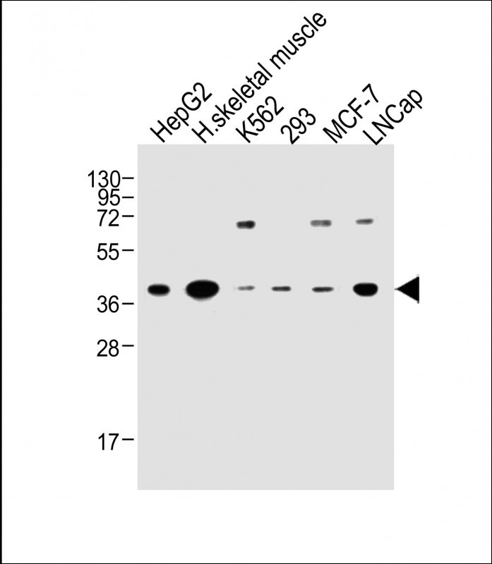 Rabbit Polyclonal Antibody to OR2H2