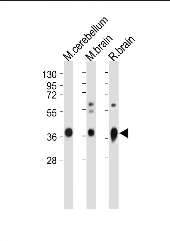 Rabbit Polyclonal Antibody to GNAO1
