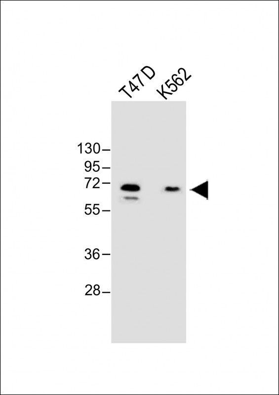 Rabbit Polyclonal Antibody to YTHD3