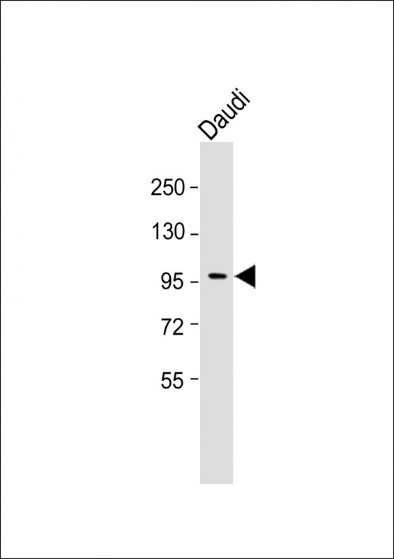 Rabbit Polyclonal Antibody to INPP5B