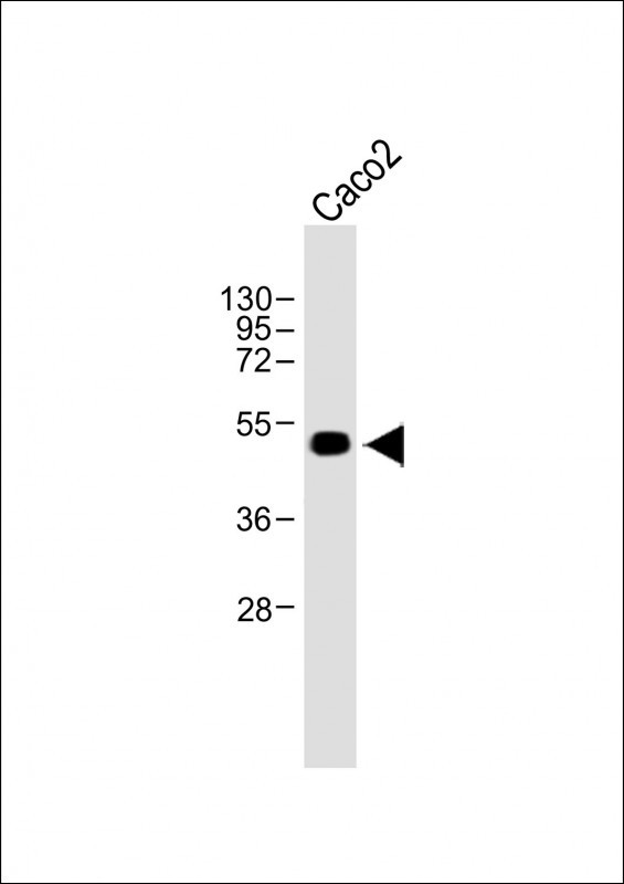 Rabbit Polyclonal Antibody to WTIP
