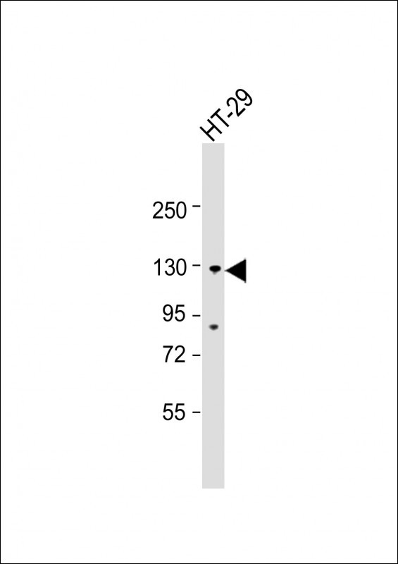 Rabbit Polyclonal Antibody to SCAP (N-term)