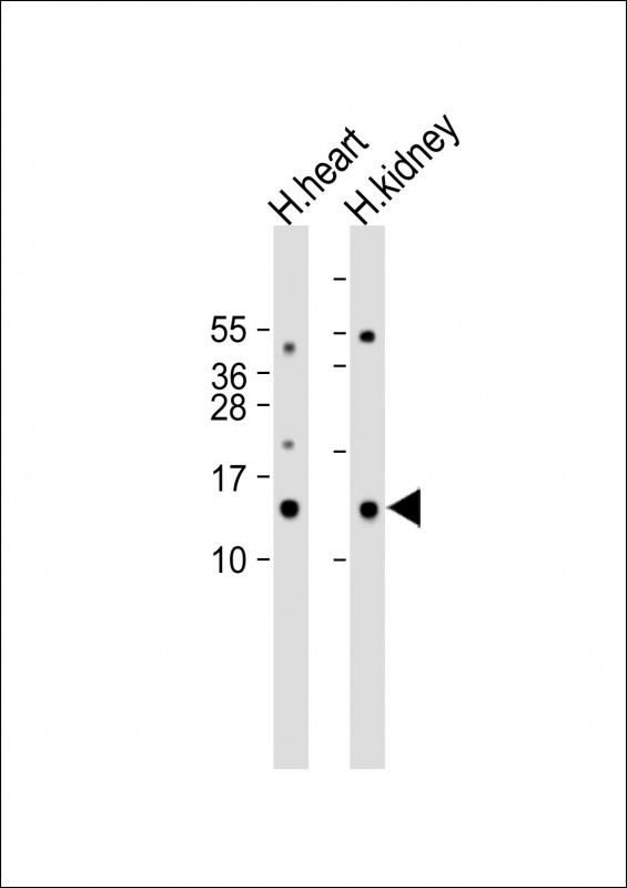 Rabbit Polyclonal Antibody to ND3 (N-term)