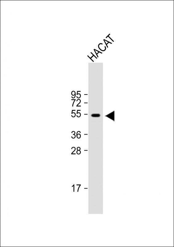 Rabbit Polyclonal Antibody to RASSF10