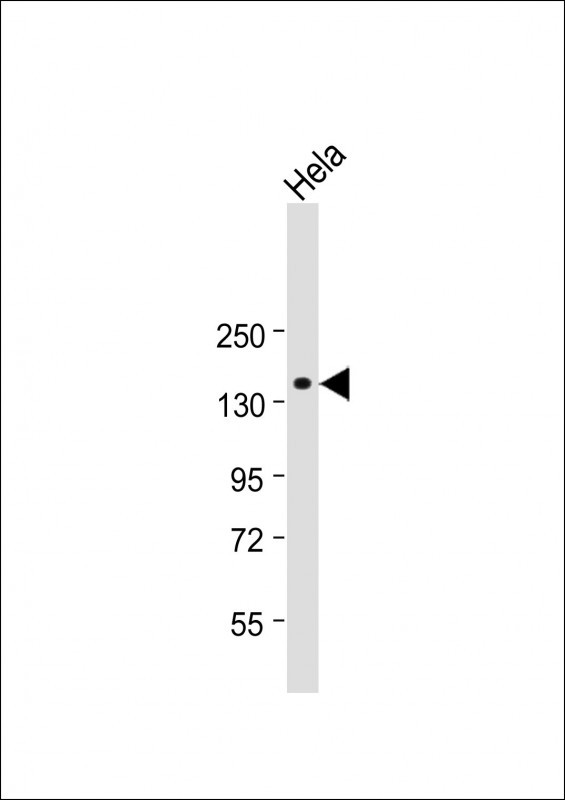 Rabbit Polyclonal Antibody to NPC1