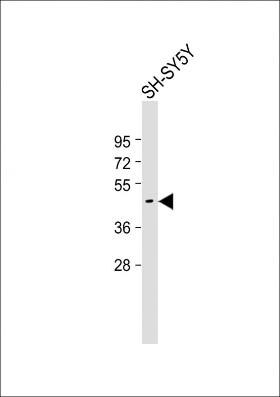Rabbit Polyclonal Antibody to TSPYL5