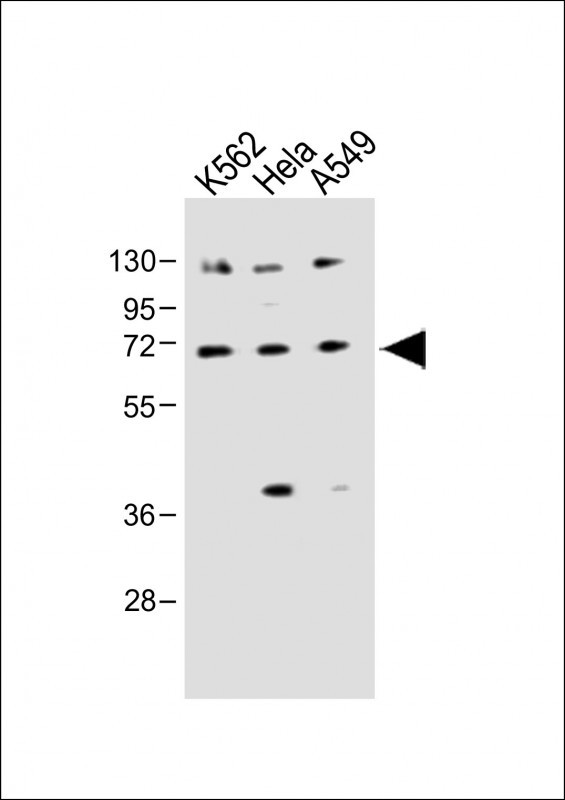 Rabbit Polyclonal Antibody to SLC22A4