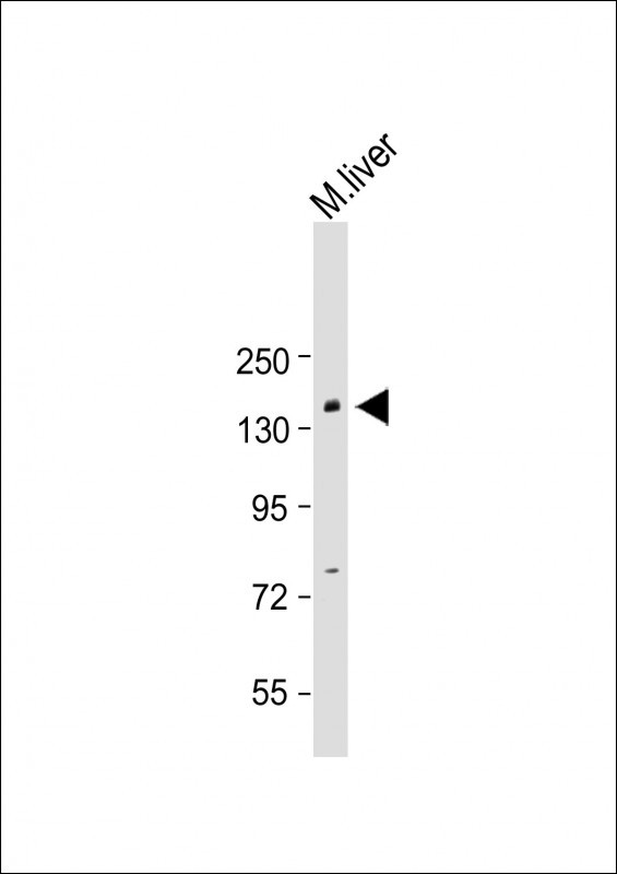 Rabbit Polyclonal Antibody to BCOR (Center S1122)