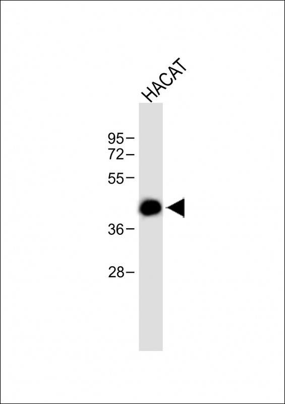Rabbit Polyclonal Antibody to MARCO (N-term)