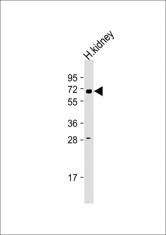 Rabbit Polyclonal Antibody to HHLA2 (N-term)