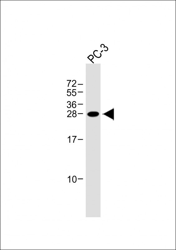 Rabbit Polyclonal Antibody to NDFIP1