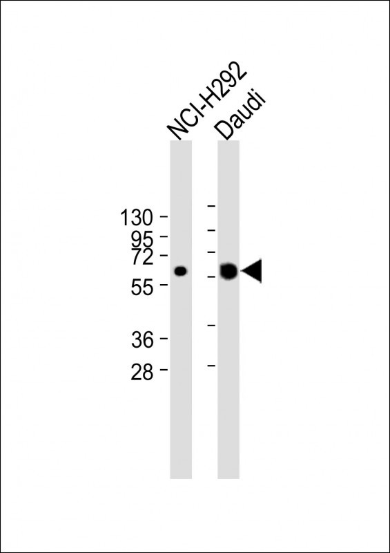 Rabbit Polyclonal Antibody to IFI44L