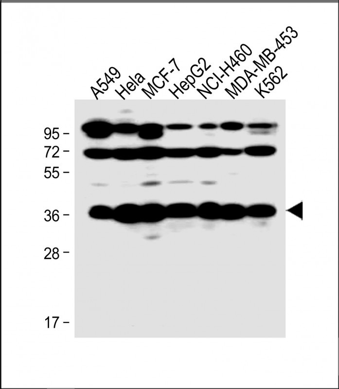 Rabbit Polyclonal Antibody to LAPTM4B-3