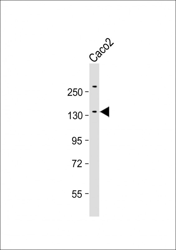 Rabbit Polyclonal Antibody to ATP7B