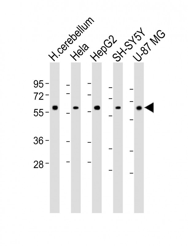 Rabbit Polyclonal Antibody to AMH
