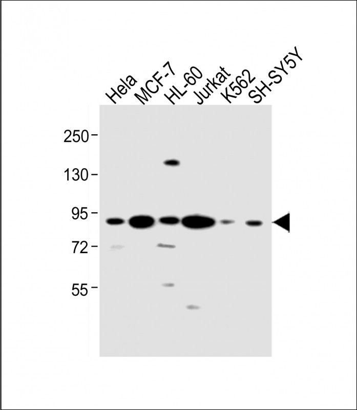 Rabbit Polyclonal Antibody to CCNT1