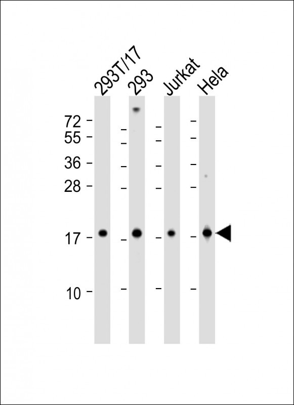 Rabbit Polyclonal Antibody to SUMO4 (M55 Wild type)